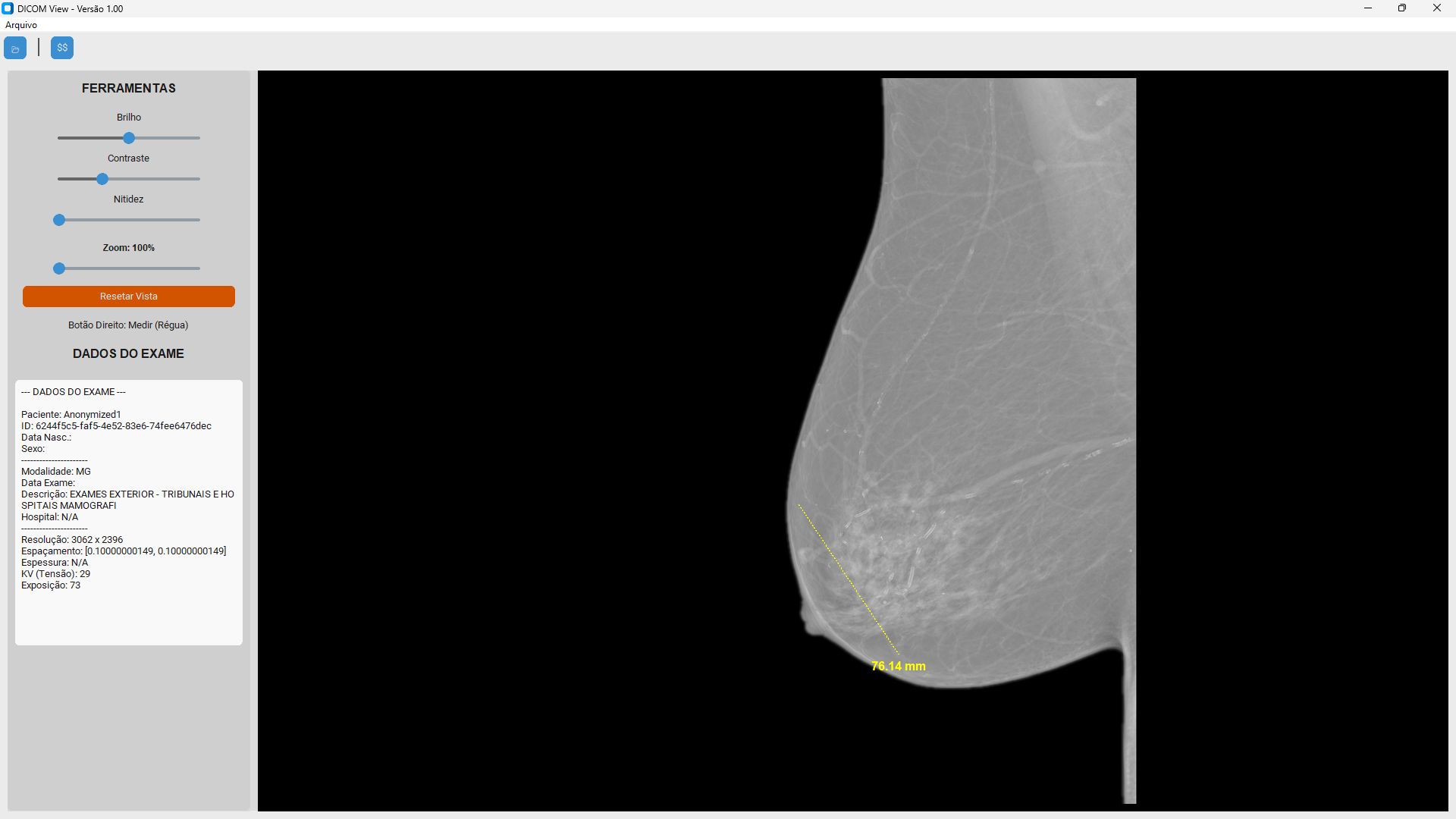 DICOM View